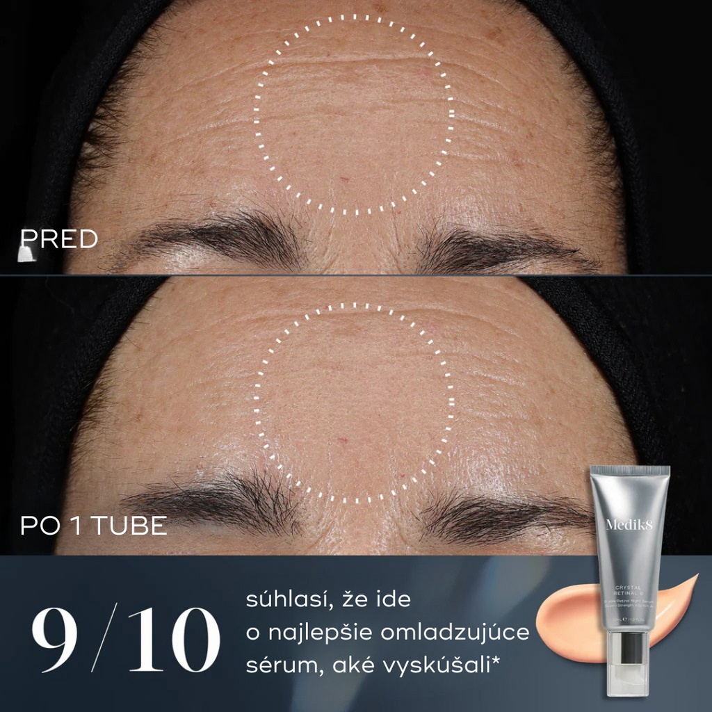 Crystal Retinal®