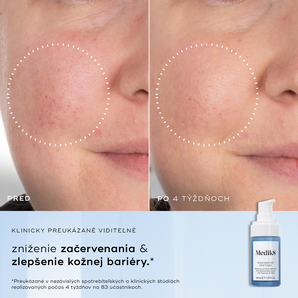 Niacinamide Peptides